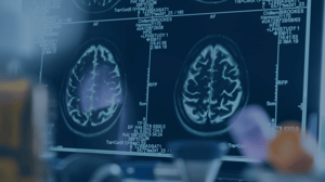 neuroimaging